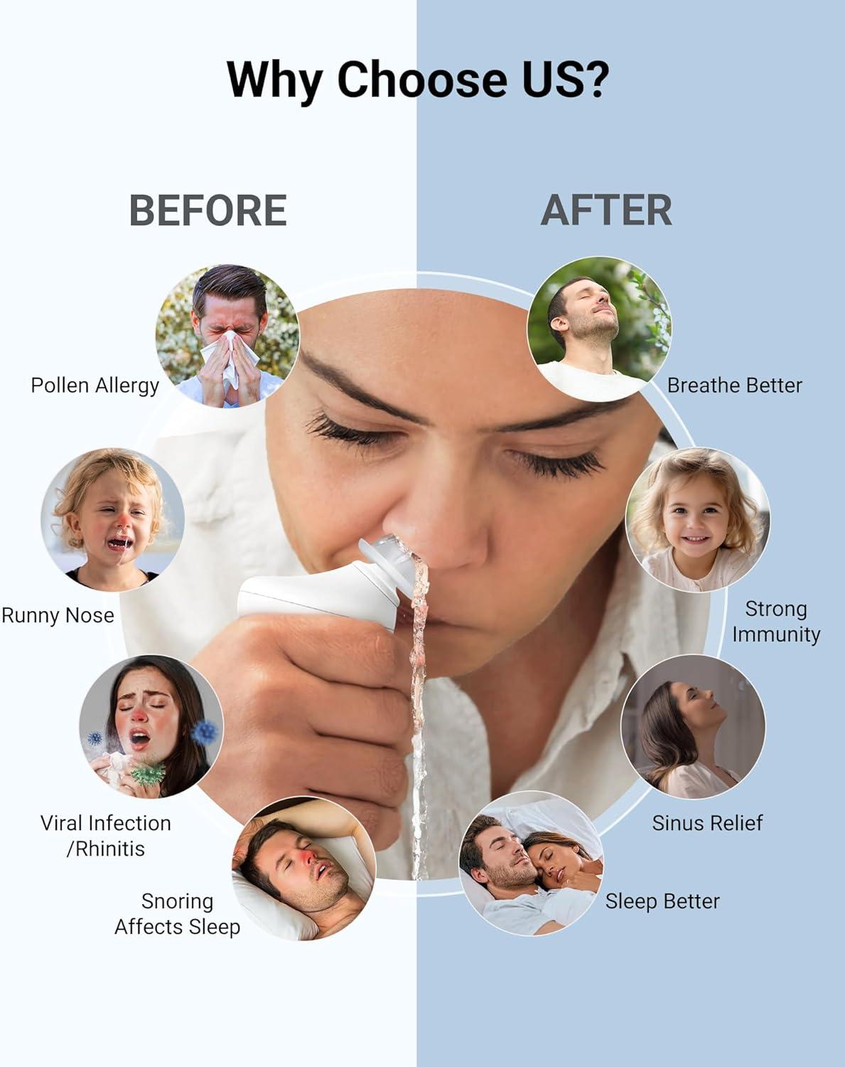 imageiHealth Electric Nasal Irrigation System for Adults ampamp Kids  Gentle Sinus Rinse for Rhinitis ampamp Sinusitis Relief 400ml EasyClean Large Tank Water Temperature Measurement 30 Premixed Saline Packets30 PCS