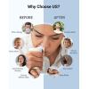 imageiHealth Electric Nasal Irrigation System for Adults ampamp Kids  Gentle Sinus Rinse for Rhinitis ampamp Sinusitis Relief 400ml EasyClean Large Tank Water Temperature Measurement 30 Premixed Saline Packets30 PCS